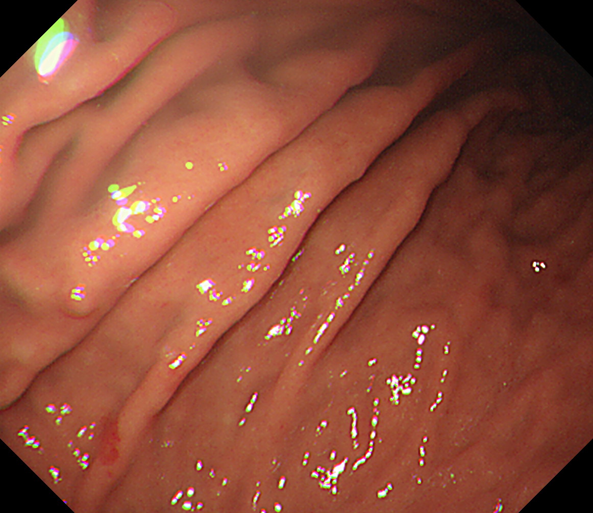 ���啔���^[�i���]]